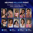 A social proof image collage featuring eight real-world users smiling while holding up their LUMEPEN devices, placed under a dark blue header that reads "HELPING MILLIONS FIGHT Acne Scars, Fine Lines, Hair Loss, Aging, and Uneven Skintone". 